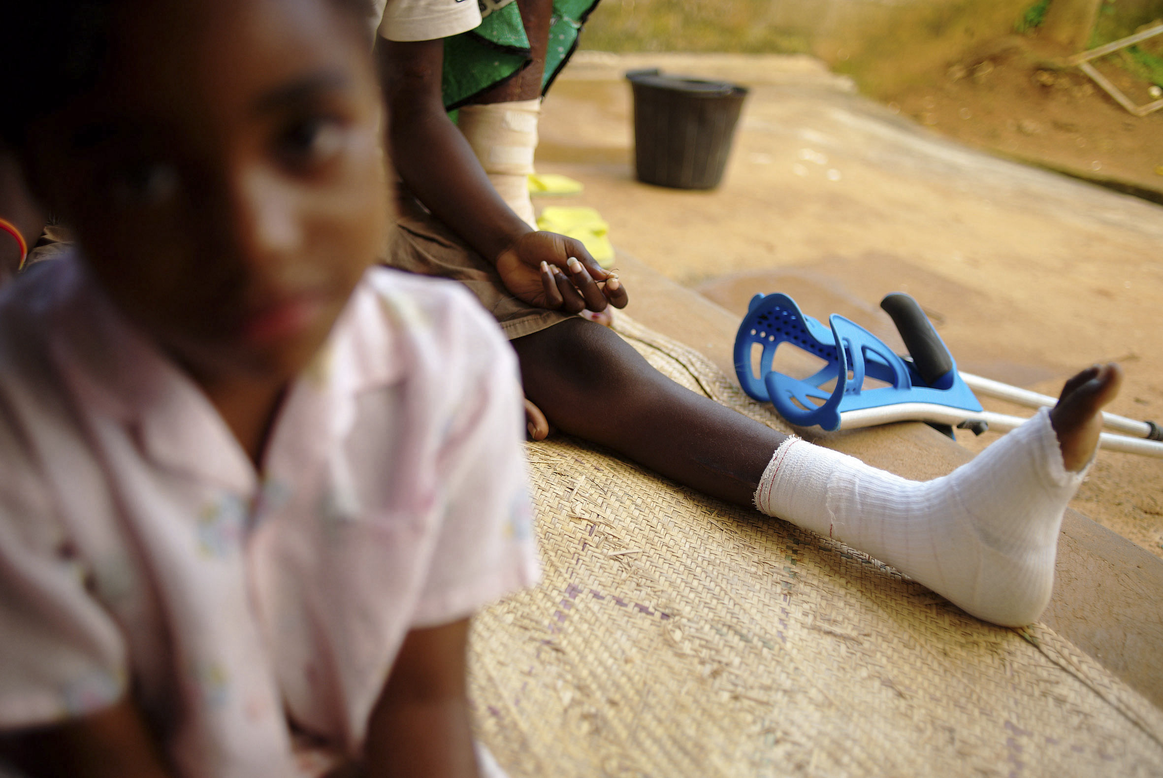 Patients of Buruli treatment centre in the rural district of Akonolinga, Cameroon. Photo by Marcell Nimfuehr.