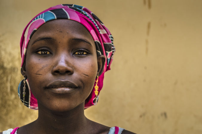 Patient treated for fistula in Nigeria. Photo by Maro Verli.